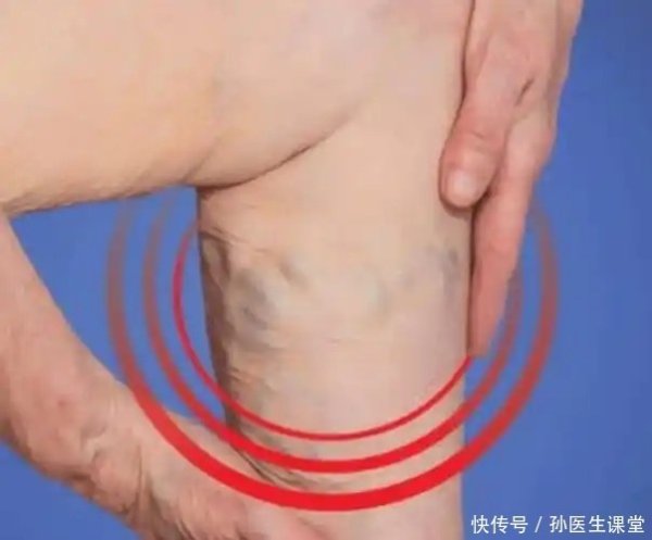 九游体育娱乐网一位50岁女性因骨质疏松导致夜间抽筋-九游「中
